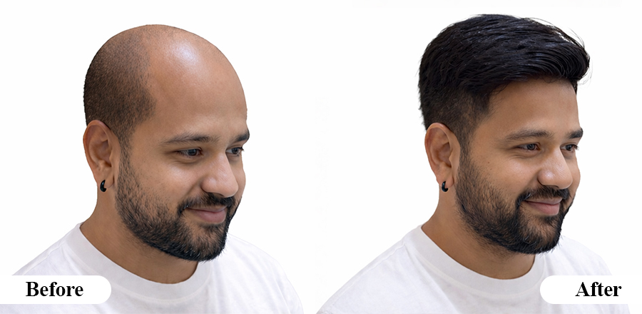 Men's Patch Ahmedabad